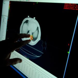 The unique needs of young cancer survivors are often overlooked