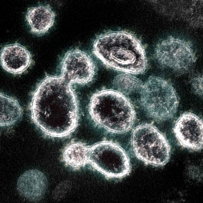 A Possible Explanation for Long COVID Gains Traction